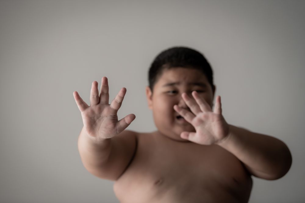 Rising Childhood Obesity in Malaysia Affecting Sleep and Learning, Says Paediatrician | KiddyNews